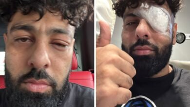 Badshah Eye Injury